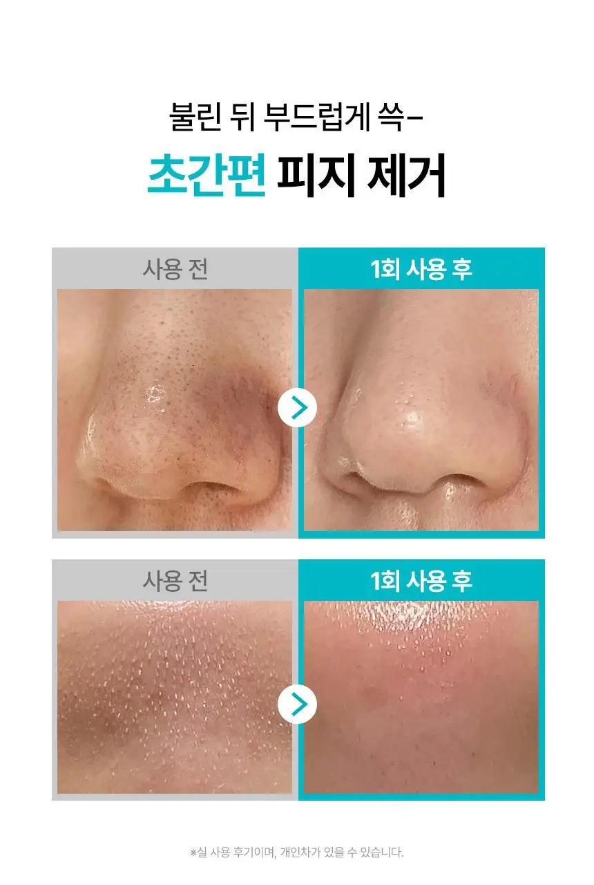 [800만개판매/1등피지클리너] 일소 슈퍼 멜팅 세범 소프트너 150g 기획 (+착붙솜 40매+모공텐션마스크팩1매) 상세페이지 14